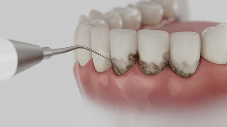Reliable Dental Implants contractor in Footville, WI by Smile Center Dentistry